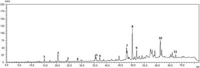 Propolis induces cardiac metabolism changes in 6-hydroxydopamine animal model: A dietary intervention as a potential cardioprotective approach in Parkinson’s disease